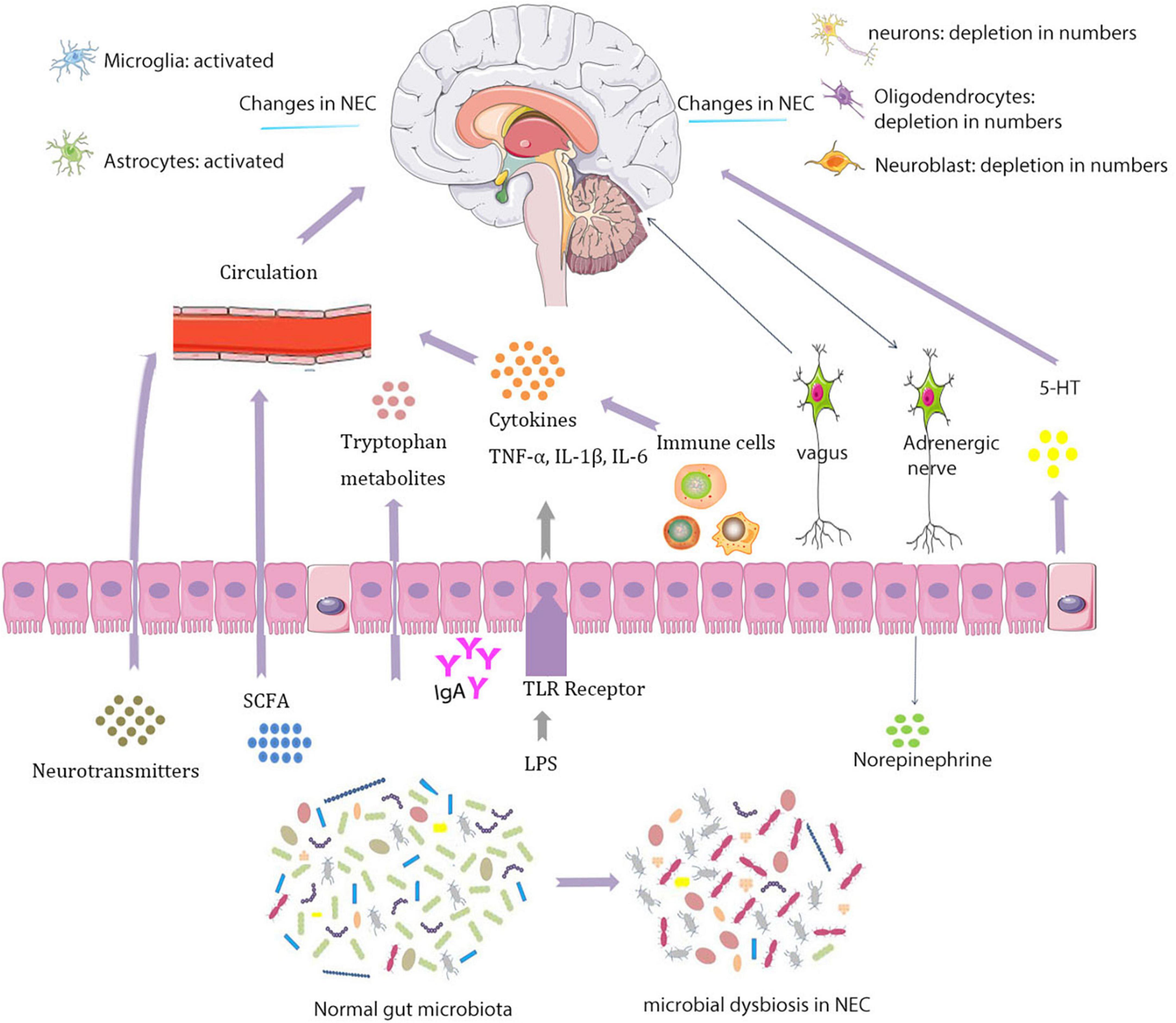 Role of gut-brain axis in neurodevelopmental impairment of necrotizing enterocolitis